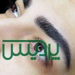 لیفت ومیکروبلیدینگ کرکی مویی