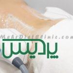 کاهش وزن با دستگاه لاغری