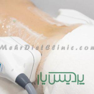 کاهش وزن با دستگاه لاغری