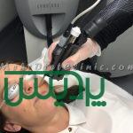 دستگاه لیزر مو های زائد