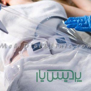 دستگاه لاغری ساکشن ترواسکالپ TruSculpt آمریکا